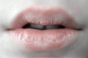 Labbra femminili secche